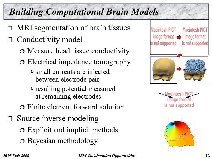 Building Computational Brain Models r r MRI segmentation of brain tissues Conductivity model ¦