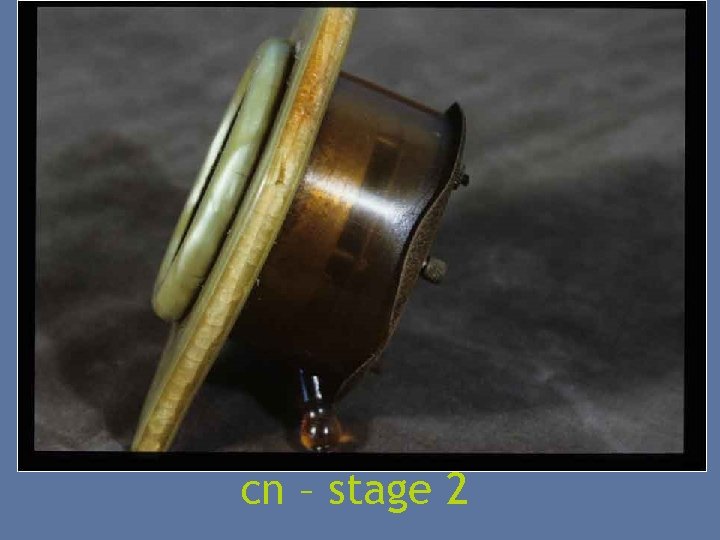 cn – stage 2 