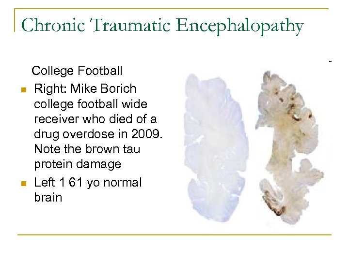 Chronic Traumatic Encephalopathy n n College Football Right: Mike Borich college football wide receiver