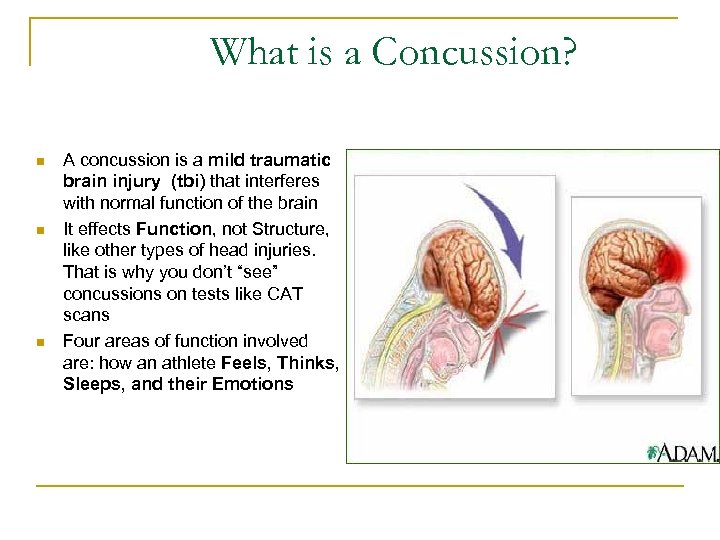 What is a Concussion? n n n A concussion is a mild traumatic brain