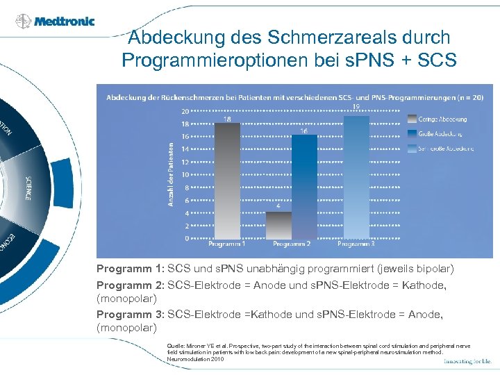 Abdeckung des Schmerzareals durch Programmieroptionen bei s. PNS + SCS Programm 1: SCS und