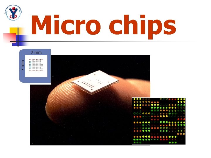 Micro chips 