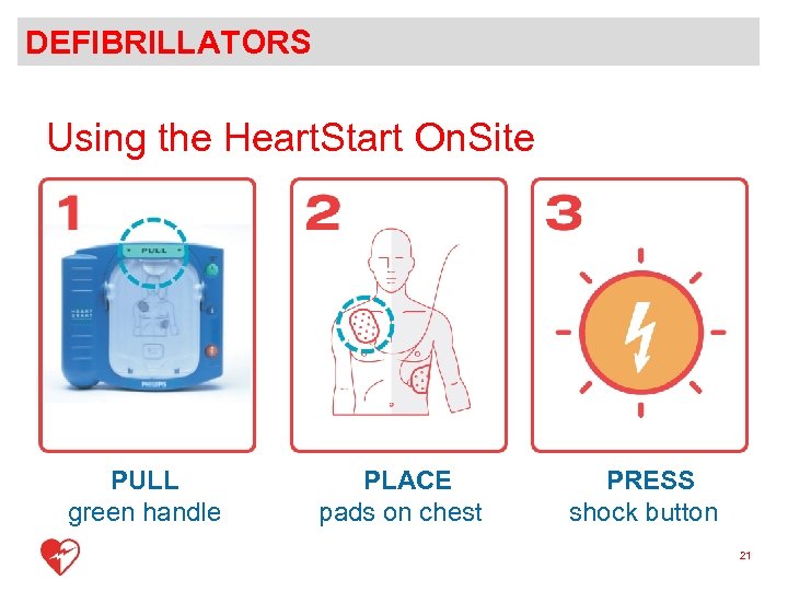 DEFIBRILLATORS Using the Heart. Start On. Site 1 PULL green handle PLACE pads on