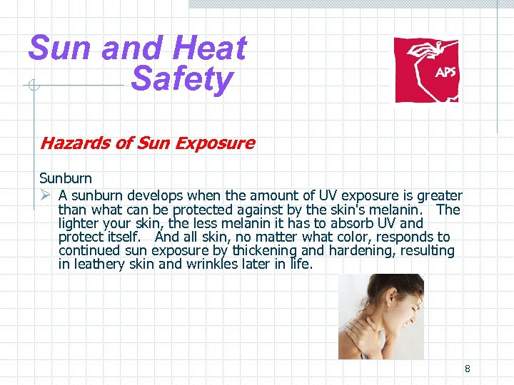Sun and Heat Safety Hazards of Sun Exposure Sunburn Ø A sunburn develops when