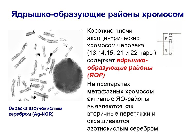 Ядрышко хромосомы. Ядрышкообразующие хромосомы. Ядрышкообразующие хромосомы в кариотипе человека. Ядрышкообразующие районы хромосом. Номера ядрышкообразующих хромосом человека.