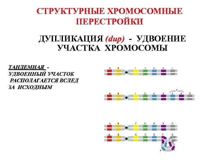 СТРУКТУРНЫЕ ХРОМОСОМНЫЕ ПЕРЕСТРОЙКИ ДУПЛИКАЦИЯ (dup) - УДВОЕНИЕ УЧАСТКА ХРОМОСОМЫ ТАНДЕМНАЯ УДВОЕННЫЙ УЧАСТОК РАСПОЛАГАЕТСЯ ВСЛЕД