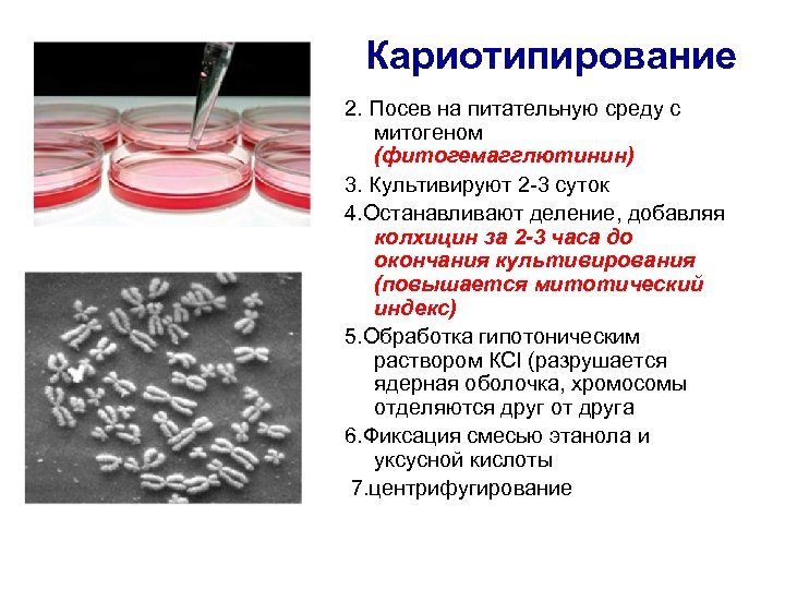 Кариотипирование с фотографией хромосом