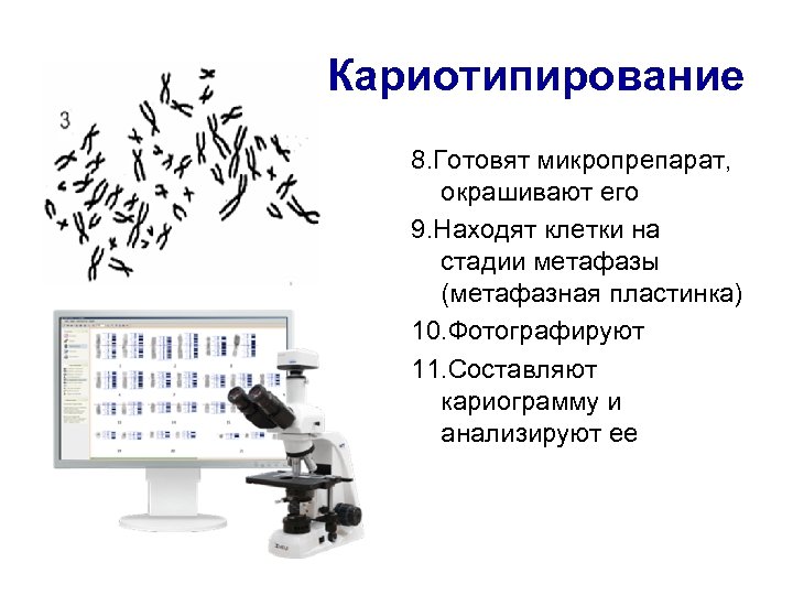 Кариотипирование 8. Готовят микропрепарат, окрашивают его 9. Находят клетки на стадии метафазы (метафазная пластинка)