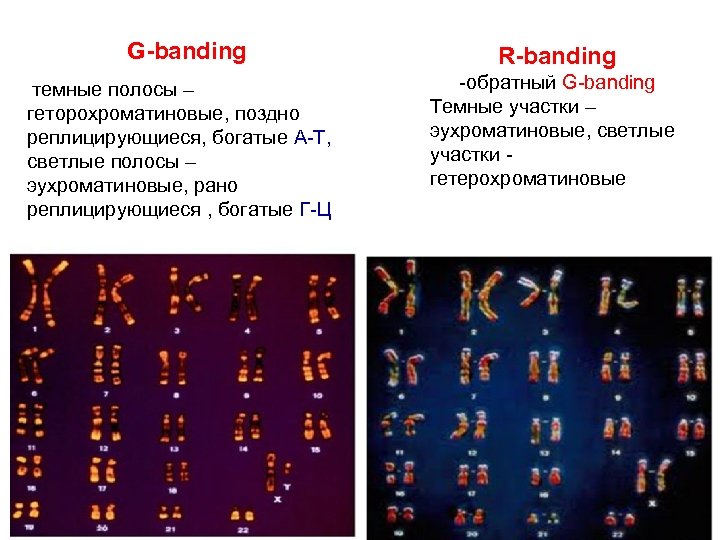 G-banding темные полосы – геторохроматиновые, поздно реплицирующиеся, богатые А-Т, светлые полосы – эухроматиновые, рано