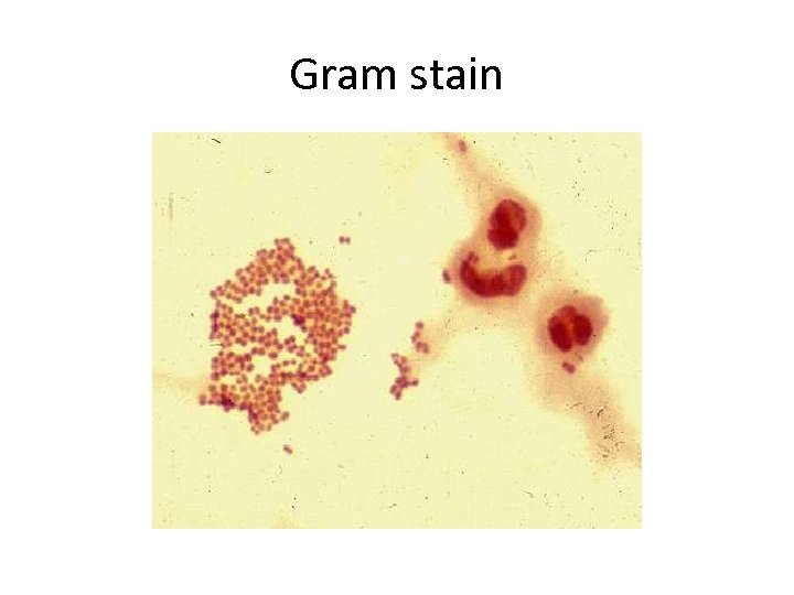 Gram stain 