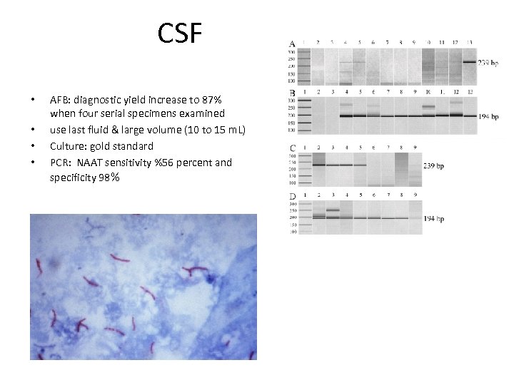 CSF • • AFB: diagnostic yield increase to 87% when four serial specimens examined