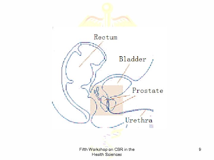 Fifth Workshop on CBR in the Health Sciences 9 