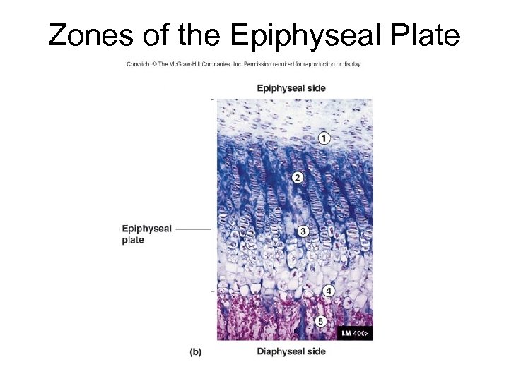 Zones of the Epiphyseal Plate 