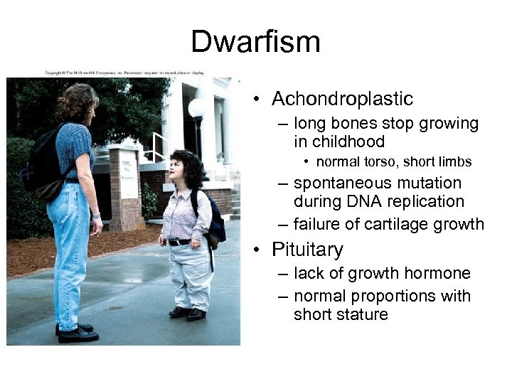 Dwarfism • Achondroplastic – long bones stop growing in childhood • normal torso, short