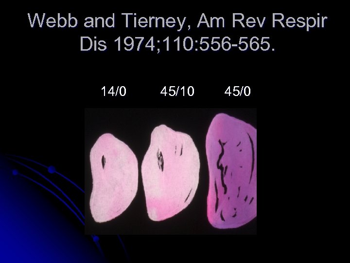 Webb and Tierney, Am Rev Respir Dis 1974; 110: 556 -565. 14/0 45/10 45/0