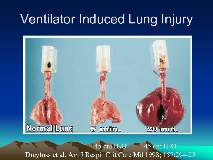 Ventilator Induced Lung Injury 45 cm H 2 O Dreyfuss et al, Am J