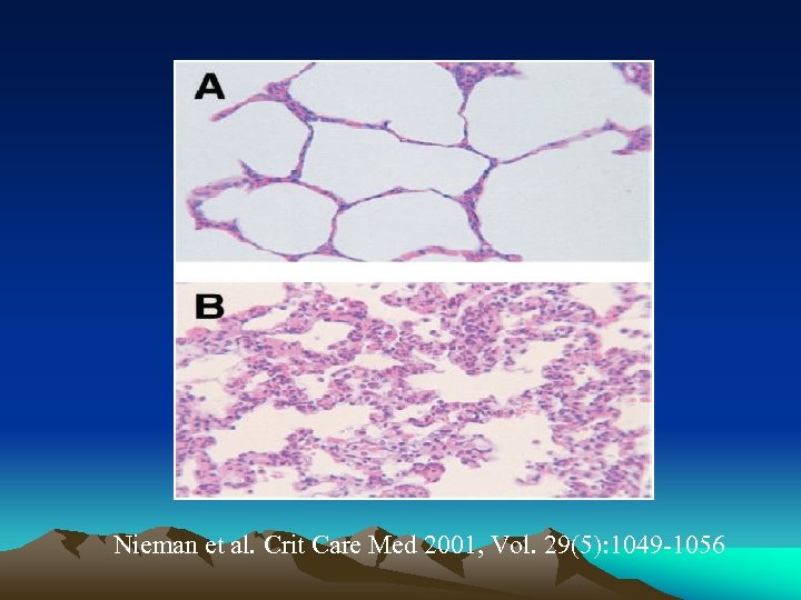Nieman et al. Crit Care Med 2001, Vol. 29(5): 1049 -1056 