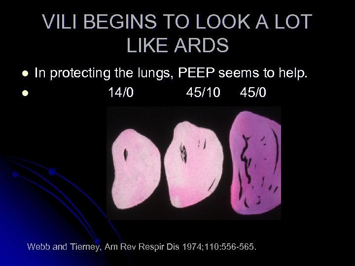 VILI BEGINS TO LOOK A LOT LIKE ARDS l l In protecting the lungs,
