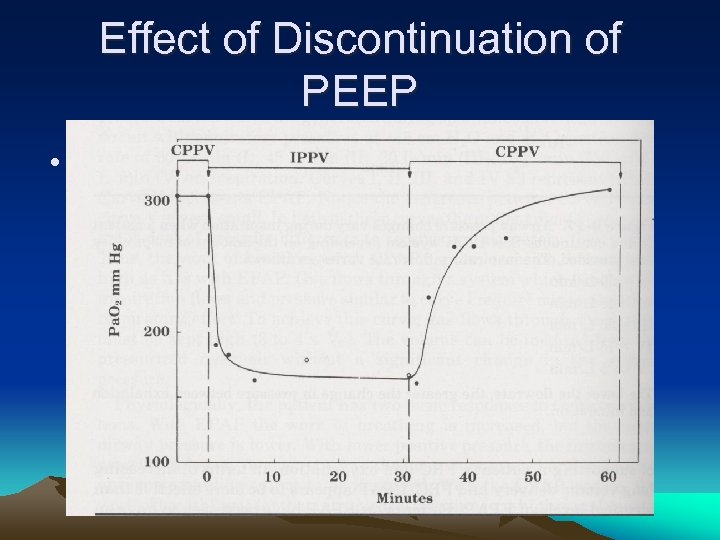 Effect of Discontinuation of PEEP • Kumar et al: NEJM 1970 (283) 