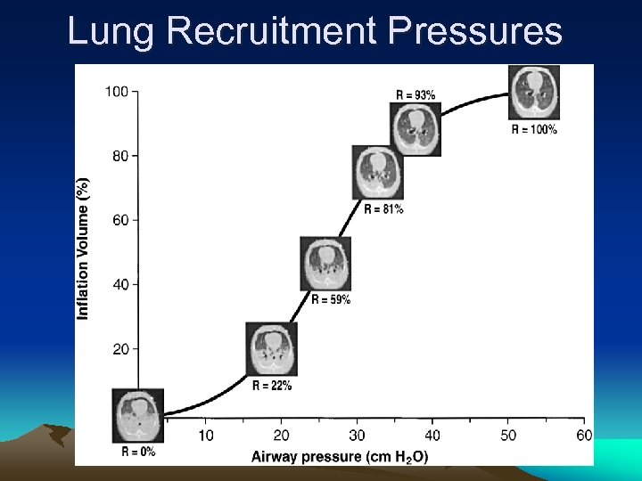 Lung Recruitment Pressures 