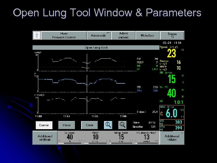 Open Lung Tool Window & Parameters 