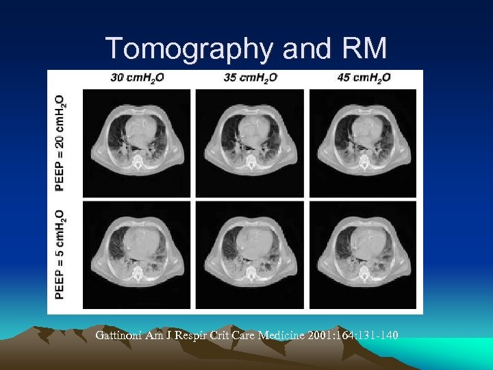 Tomography and RM Gattinoni Am J Respir Crit Care Medicine 2001: 164: 131 -140