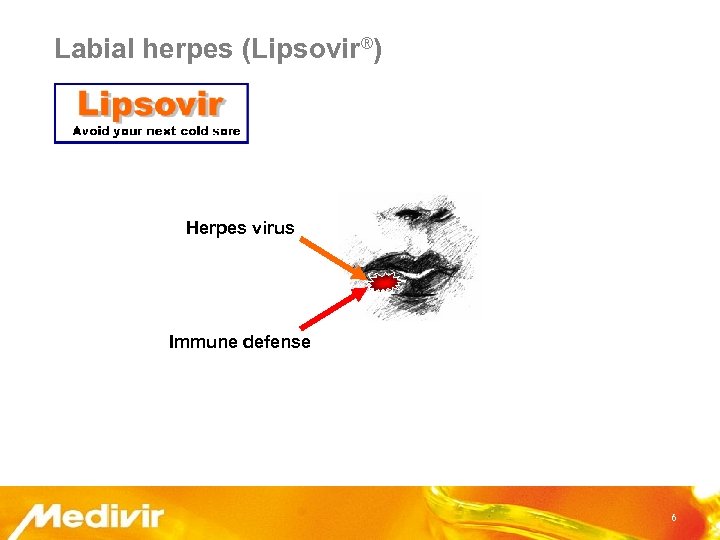 Labial herpes (Lipsovir®) Herpes virus Immune defense 6 