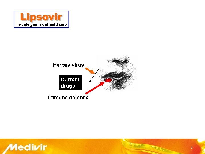 Herpes virus Current drugs Immune defense 7 