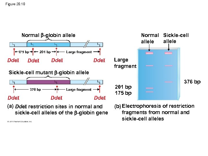 Figure 20. 10 Normal -globin allele 175 bp Dde. I Large fragment 201 bp
