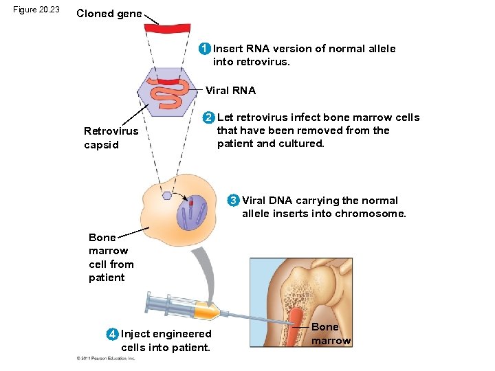 Figure 20. 23 Cloned gene 1 Insert RNA version of normal allele into retrovirus.