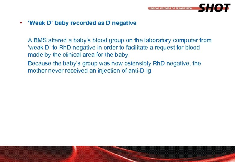  • ‘Weak D’ baby recorded as D negative A BMS altered a baby’s