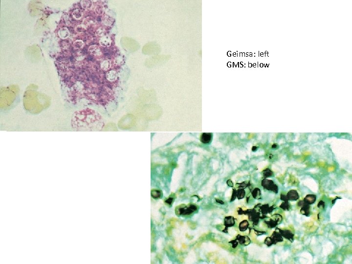 Geimsa: left GMS: below 16 