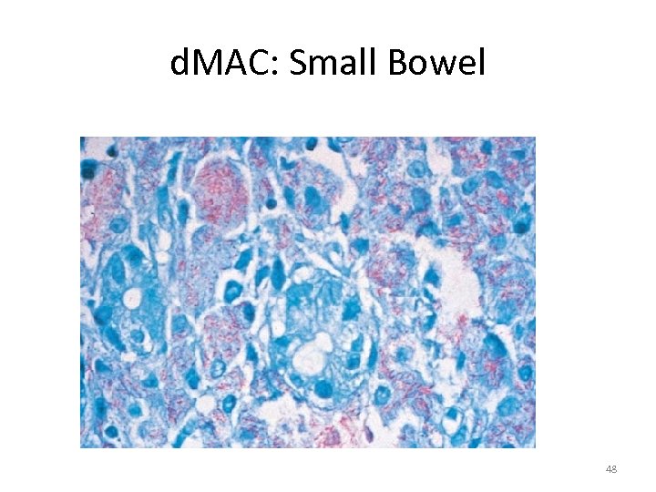 d. MAC: Small Bowel 48 