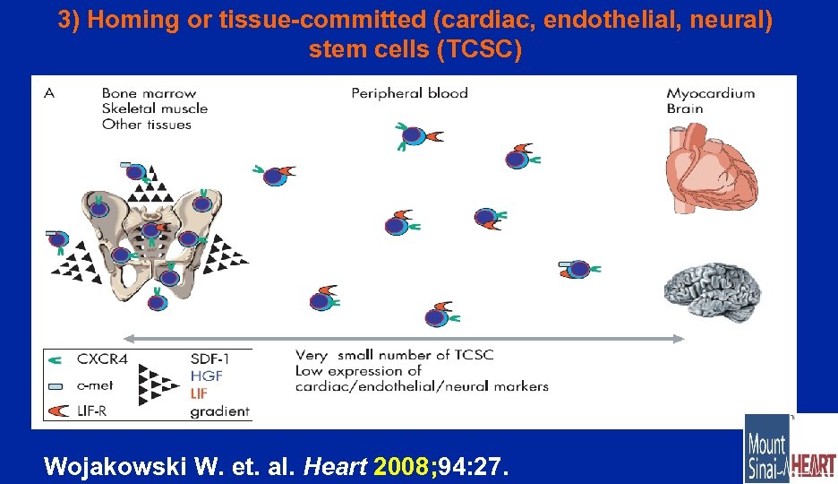 3) Homing or tissue-committed (cardiac, endothelial, neural) stem cells (TCSC) Wojakowski W. et. al.