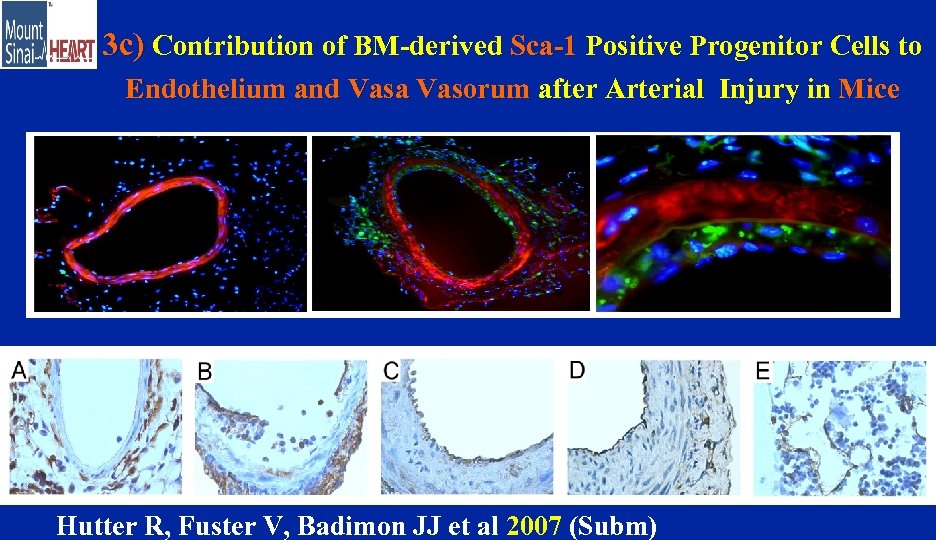 3 c) Contribution of BM-derived Sca-1 Positive Progenitor Cells to Endothelium and Vasa Vasorum