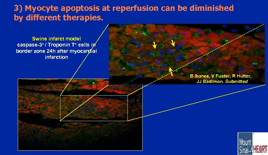 3) Myocyte apoptosis at reperfusion can be diminished by different therapies. Swine infarct model