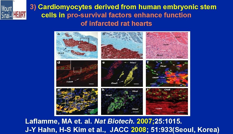 3) Cardiomyocytes derived from human embryonic stem cells in pro-survival factors enhance function of