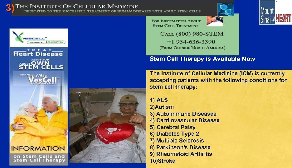 3) Stem Cell Therapy is Available Now The Institute of Cellular Medicine (ICM) is