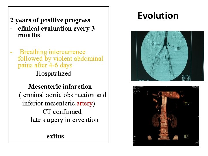 2 years of positive progress - clinical evaluation every 3 months - Breathing intercurrence