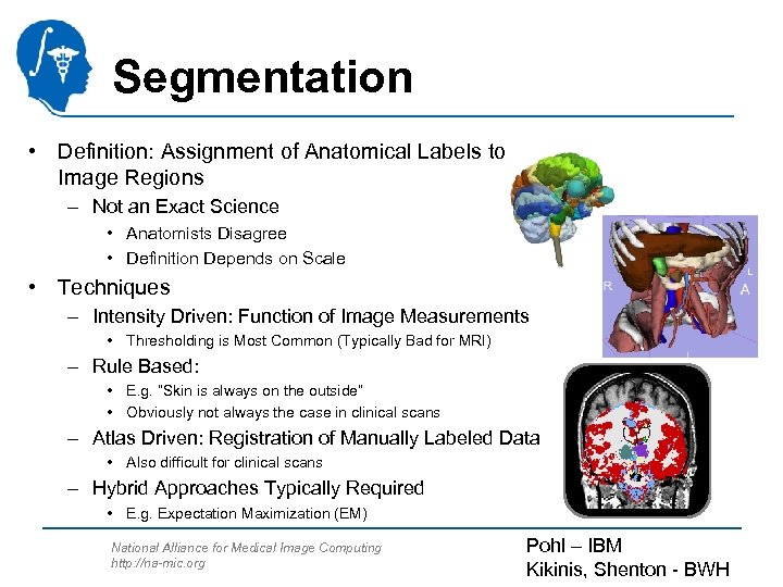Segmentation • Definition: Assignment of Anatomical Labels to Image Regions – Not an Exact