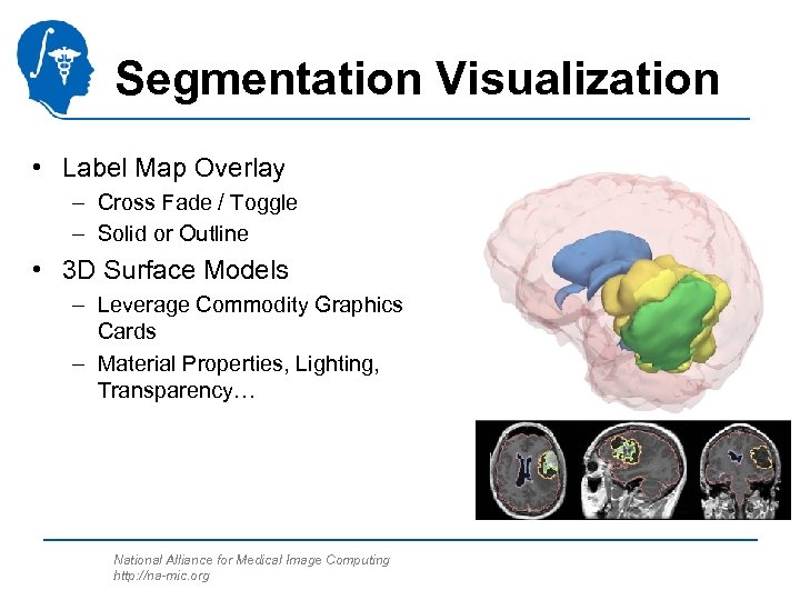 Segmentation Visualization • Label Map Overlay – Cross Fade / Toggle – Solid or