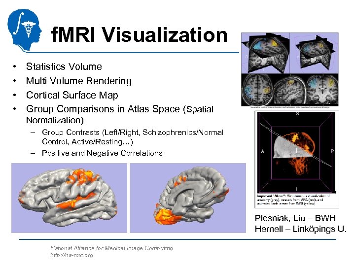 f. MRI Visualization • • Statistics Volume Multi Volume Rendering Cortical Surface Map Group