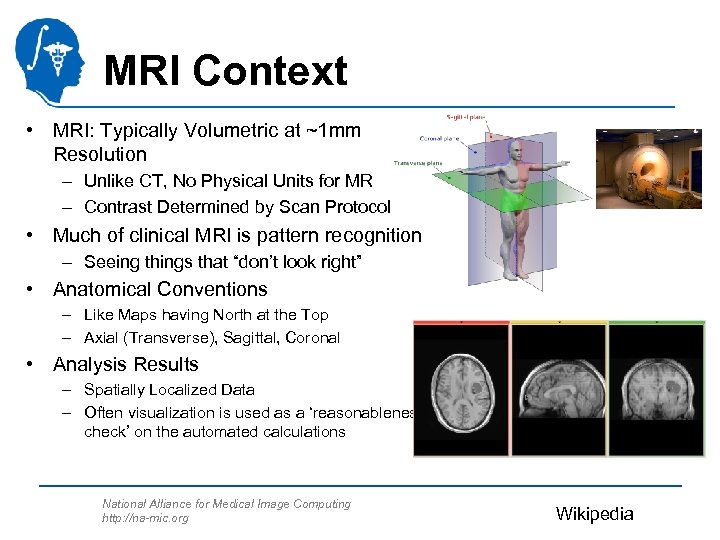 MRI Context • MRI: Typically Volumetric at ~1 mm Resolution – Unlike CT, No