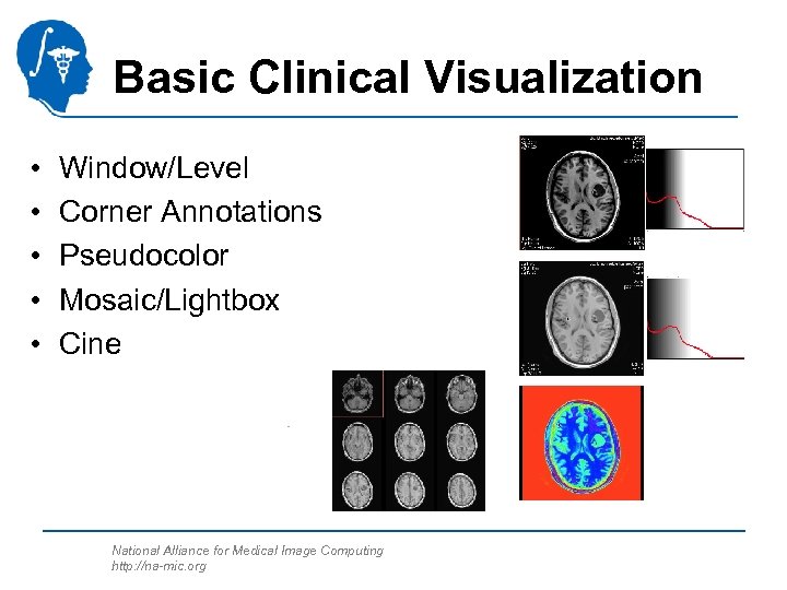 Basic Clinical Visualization • • • Window/Level Corner Annotations Pseudocolor Mosaic/Lightbox Cine National Alliance