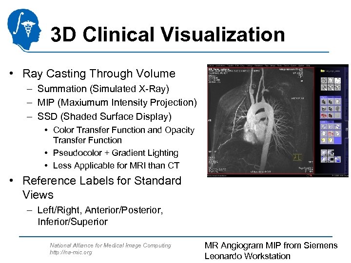 3 D Clinical Visualization • Ray Casting Through Volume – Summation (Simulated X-Ray) –