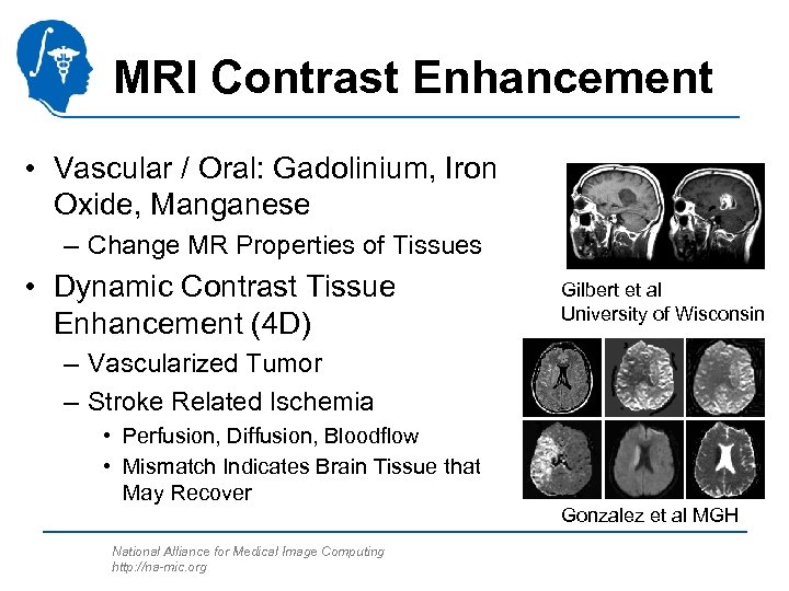 MRI Contrast Enhancement • Vascular / Oral: Gadolinium, Iron Oxide, Manganese – Change MR