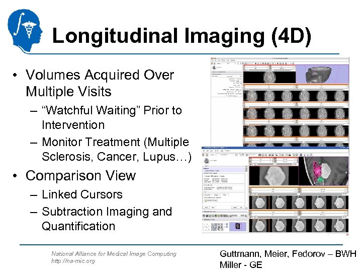Longitudinal Imaging (4 D) • Volumes Acquired Over Multiple Visits – “Watchful Waiting” Prior