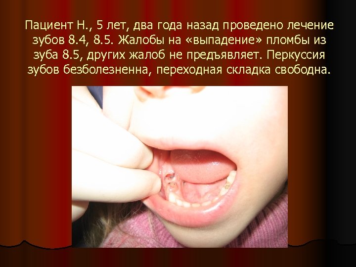 Пациент Н. , 5 лет, два года назад проведено лечение зубов 8. 4, 8.