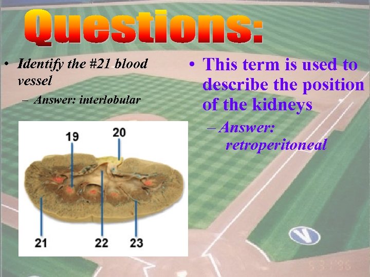  • Identify the #21 blood vessel – Answer: interlobular • This term is