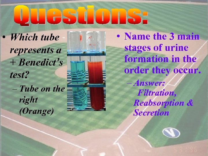  • Which tube represents a + Benedict’s test? – Tube on the right